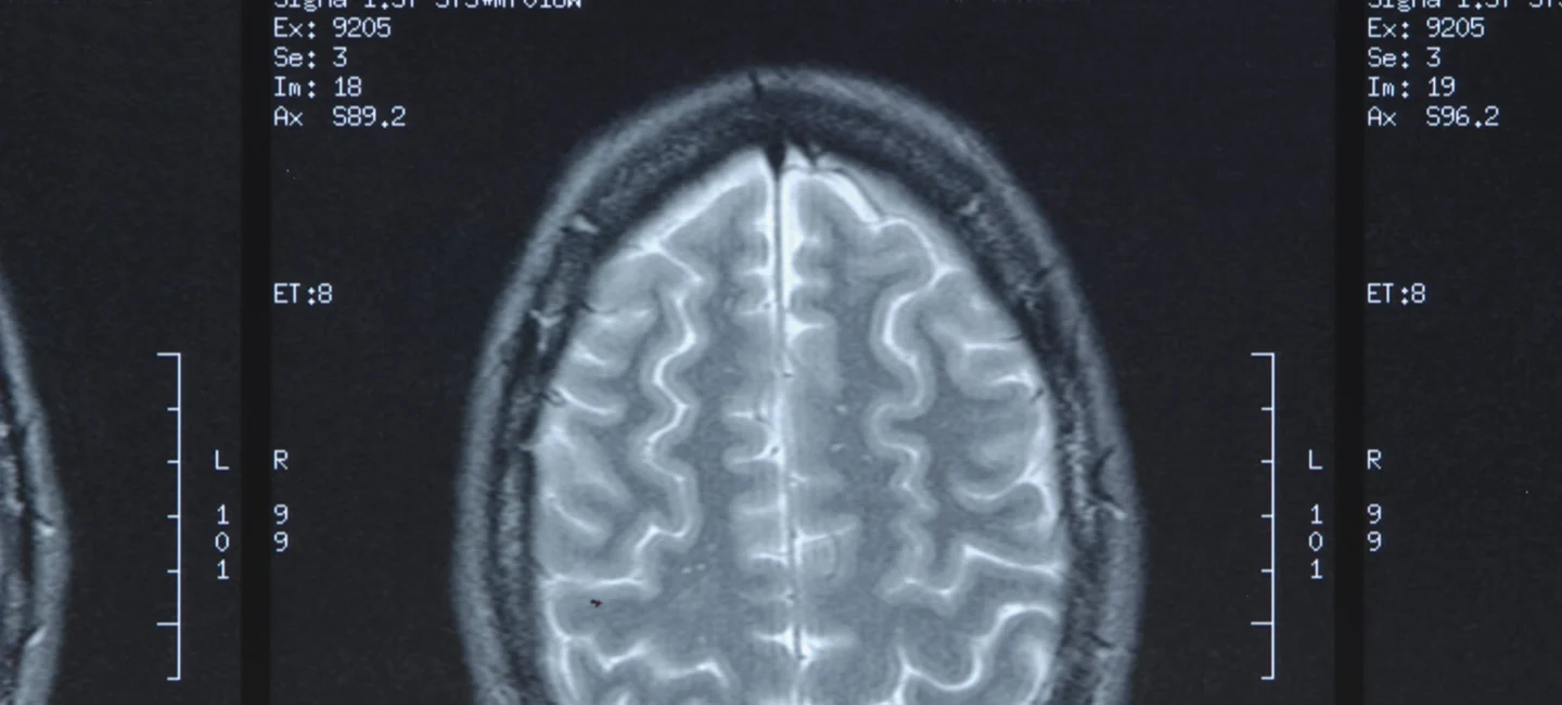 Catastrophic Injury Featured Image