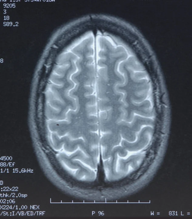 $14M Jury Trial Win in Wrongful Death Case Againt University of Chicago Medical Center $14M Jury Trial Win in Wrongful Death Case Againt University of Chicago Medical Center